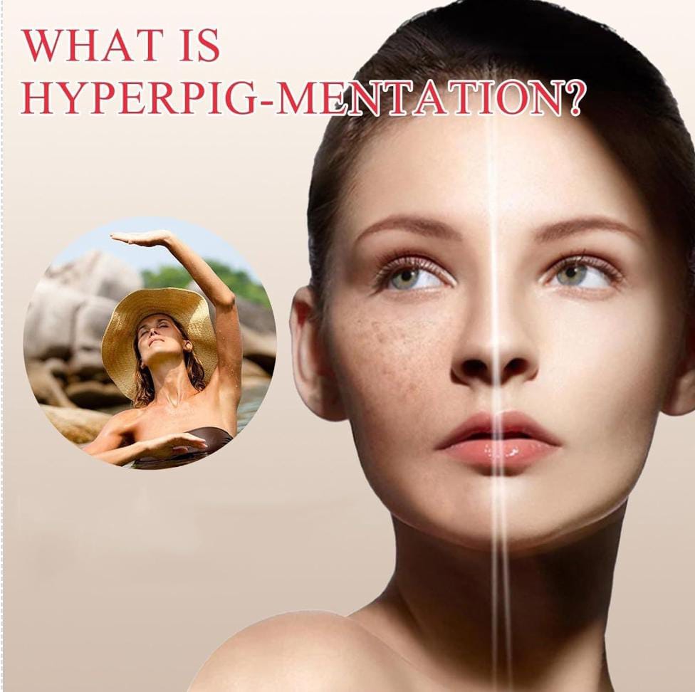 Eelhoe - Brightening & Clearing Serum  1.7 fl oz (50 ml) (Original)