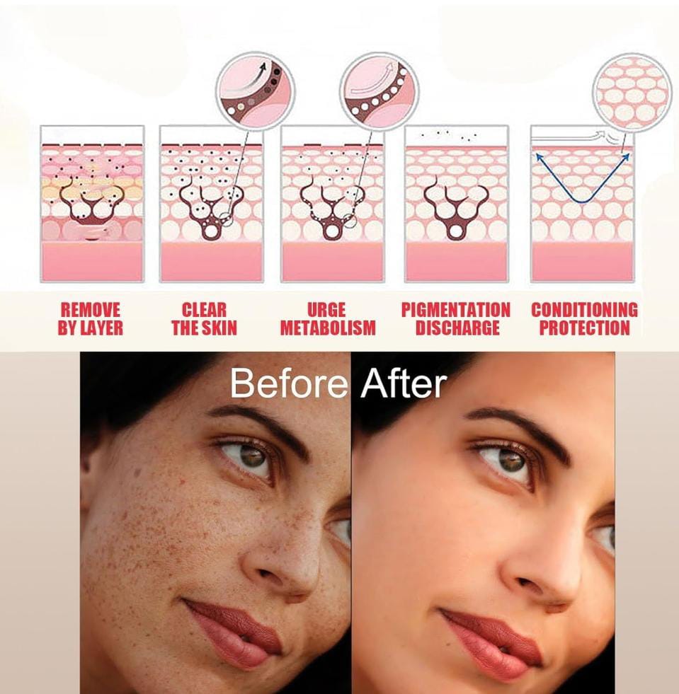 Eelhoe - Brightening & Clearing Serum  1.7 fl oz (50 ml) (Original)