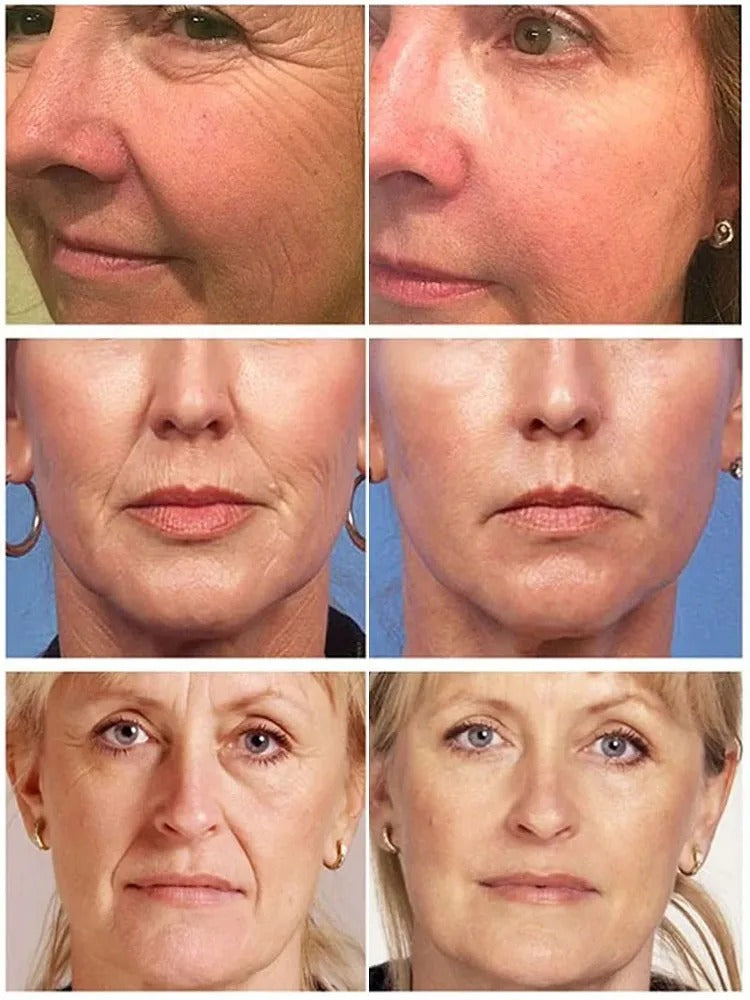 Wrinkle Brighten Beauty Skin Care Products